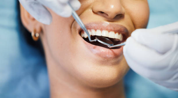 Best Emergency Tooth Extraction in Hiram, GA