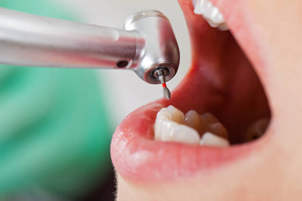 Best Weekend Emergency Dentist in Hiram, GA